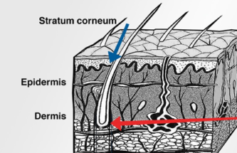 TRANSDERMAL DELIVERY DEVICE DESIGN