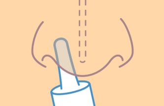 ADDRESSING THE CHALLENGES OF NASAL BIOTHERAPEUTIC DRUG DELIVERY